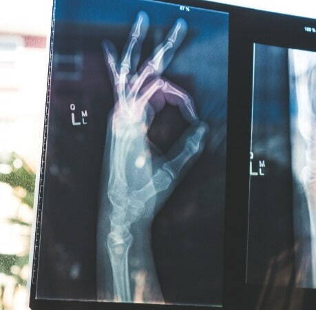 hand x-ray